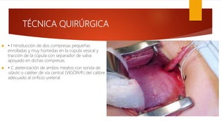 TÉCNICA QUIRÚRGICA
 • I ntroducción de dos compresas pequeñas
enrolladas y muy húmedas en la cúpula vesical y
tracción de la cúpula con separador de valva
apoyado en dichas compresas.
 • C ateterización de ambos meatos con sonda de
silastic o catéter de vía central (VIGÓN®) del calibre
adecuado al orificio ureteral.
 