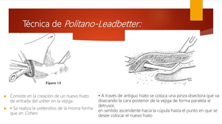 Técnica de Politano-Leadbetter:
 Consiste en la creación de un nuevo hiato
de entrada del uréter en la vejiga.
 • Se realiza la ureterolisis de la misma forma
que en Cohen.
• A través de antiguo hiato se coloca una pinza disectora que va
disecando la cara posterior de la vejiga de forma paralela al
detrusor,
en sentido ascendente hacia la cúpula hasta el punto en que se
desee colocar el nuevo hiato
 