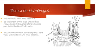 Técnica de Lich-Gregoir:
 Se trata de una técnica extravesical. •
 Se colocará en primer lugar una sonda de
Foley a través de la cual se rellenará la vejiga
para facilitar la disección del uréter.
 Traccionando del uréter, este es separado de la
vejiga y disecado con una pinza disectora.
 