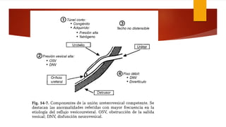Clase n2.infeccion urinaria y reflujo