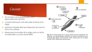 Causas:
 Se considera varias posibilidades como
desencadenantes del RVU:
 un túnel submucoso corto del uréter al entrar en la
vejiga
 presiones vesicales altas que dispararían de nuevo la
orina a los uréteres
 alteraciones funcionales de la vejiga como un techo
no distensible o un piso vesical débil.
 