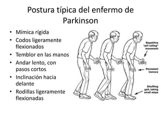 Postura típica del enfermo de
                Parkinson
• Mímica rígida
• Codos ligeramente
  flexionados
• Temblor en las manos
• Andar lento, con
  pasos cortos
• Inclinación hacia
  delante
• Rodillas ligeramente
  flexionadas
 