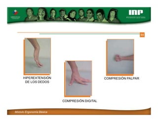 44
COMPRESIÓN DIGITAL
COMPRESIÓN PALPAR
HIPEREXTENSIÓN
DE LOS DEDOS
Módulo Ergonomía Básica
 