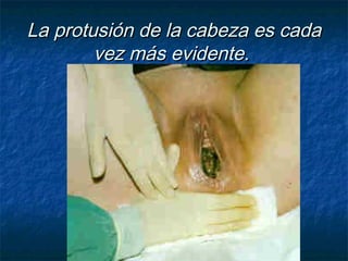 La protusión de la cabeza es cadaLa protusión de la cabeza es cada
vez más evidente.vez más evidente.
 