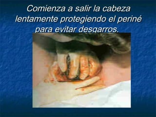 Comienza a salir la cabezaComienza a salir la cabeza
lentamente protegiendo el perinélentamente protegiendo el periné
para evitar desgarros.para evitar desgarros.
 