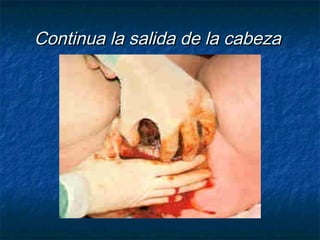 Continua la salida de la cabezaContinua la salida de la cabeza
 