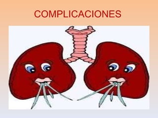 COMPLICACIONES 
