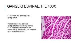 GANGLIO ESPINAL. H E 400X
Septación del parénquima
ganglionar
Presencia de las células
ganglionares con citoplasma
vacuolizado y núcleos bien
definidos y basófilos, contienen
granulaciones finas.
 