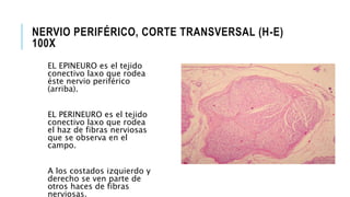 NERVIO PERIFÉRICO, CORTE TRANSVERSAL (H-E)
100X
EL EPINEURO es el tejido
conectivo laxo que rodea
éste nervio periférico
(arriba).
EL PERINEURO es el tejido
conectivo laxo que rodea
el haz de fibras nerviosas
que se observa en el
campo.
A los costados izquierdo y
derecho se ven parte de
otros haces de fibras
nerviosas.
 
