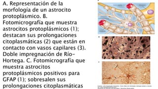 A. Representación de la
morfología de un astrocito
protoplásmico. B.
Fotomicrografía que muestra
astrocitos protoplásmicos (1);
destacan sus prolongaciones
citoplasmáticas (2) que están en
contacto con vasos capilares (3).
Doble impregnación de Río-
Hortega. C. Fotomicrografía que
muestra astrocitos
protoplásmicos positivos para
GFAP (1); sobresalen sus
prolongaciones citoplasmáticas
 