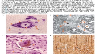 A. FOTOMICROGRAFÍA QUE MUESTRA UNA NEURONA, SU NUCLEOLO (1), NÚCLEO (2), SUSTANCIA DE NISSL (3),
CONO DEL AXÓN (4), CÉLULAS DE LA GLÍA (5), NEURÓPILO (6), ADEMÁS DE UN VASO CAPILAR (7). TINCIÓN CON
TIONINA. B. ELECTROMICROGRAFÍA DE UNA NEURONA; SE OBSERVAN EL NÚCLEO (1), NUCLEOLO (2), SUSTANCIA
DE NISSL (3), CONO AXÓNICO (4), AXÓN (5), DENDRITAS (6), NEURÓPILO REGIÓN CON ALTA CANTIDAD DE FIRBAS
NERVIOSAS (7) Y CAPILARES (8). MICROSCOPIA ELECTRÓNICA DE TRANSMISIÓN. C. FOTOMICROGRAFÍA QUE
REVELA UNA NEURONA CON SU NÚCLEO (1), GRÁNULOS DE LIPOFUCSINA (2), CÉLULAS SATÉLITE (3) Y CÉLULAS
DE SCHWANN (4). H Y E. D. FOTOMICROGRAFÍA QUE MUESTRA NEURONAS PIRAMIDALES CON POSITIVIDAD PARA
NEUROFILAMENTOS (FLECHAS). INMUNOHISTOQUÍMICA.
 