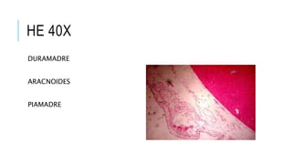 HE 40X
DURAMADRE
ARACNOIDES
PIAMADRE
 