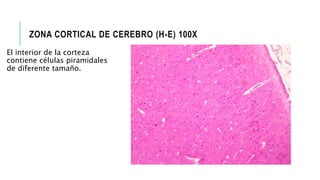 ZONA CORTICAL DE CEREBRO (H-E) 100X
El interior de la corteza
contiene células piramidales
de diferente tamaño.
 