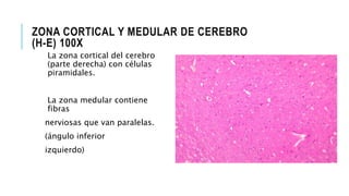 ZONA CORTICAL Y MEDULAR DE CEREBRO
(H-E) 100X
La zona cortical del cerebro
(parte derecha) con células
piramidales.
La zona medular contiene
fibras
nerviosas que van paralelas.
(ángulo inferior
izquierdo)
 