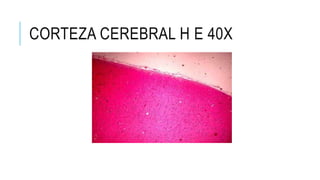 CORTEZA CEREBRAL H E 40X
 
