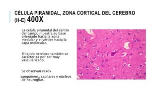 CÉLULA PIRAMIDAL, ZONA CORTICAL DEL CEREBRO
(H-E) 400X
La célula piramidal del centro
del campo muestra su base
orientado hacia la zona
medular y el vértice hacia la
capa molecular.
El tejido nervioso también se
caracteriza por ser muy
vascularizado.
Se observan vasos
sanguíneos, capilares y núcleos
de neuroglias.
 