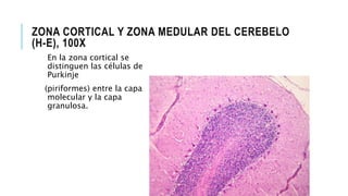ZONA CORTICAL Y ZONA MEDULAR DEL CEREBELO
(H-E), 100X
En la zona cortical se
distinguen las células de
Purkinje
(piriformes) entre la capa
molecular y la capa
granulosa.
 