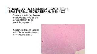 SUSTANCIA GRIS Y SUSTANCIA BLANCA, CORTE
TRANSVERSAL, MÉDULA ESPINAL (H-E), 100X
Sustancia gris (arriba) con
cuerpos neuronales del
asta anterior de la
médula espinal.
Sustancia blanca (abajo)
con fibras nerviosas en
corte transversal.
 