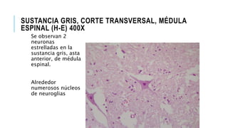 SUSTANCIA GRIS, CORTE TRANSVERSAL, MÉDULA
ESPINAL (H-E) 400X
Se observan 2
neuronas
estrelladas en la
sustancia gris, asta
anterior, de médula
espinal.
Alrededor
numerosos núcleos
de neuroglias
 