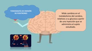 TOMOGRAFÍA DE EMISIÓN
DE POSITRONES Mide cambios en el
metabolismo del cerebro,
relativos a su glucosa a partir
de una inyección que se
administra al sujeto
estudiado.
 
