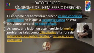 DATO CURIOSO:
SÍNDROME DEL HEMISFERIODERECHO
El síndrome del hemisferio derecho es una condición
neurológica en la que la sustancia blanca de esta
estructura cerebral ha sido dañada.
Así pues, una lesión en este hemisferio implica
problemas tales como dificultades a la hora de
interpretar los gestos faciales y las variaciones
posturales.
 