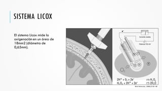 Licox Neuromonitoreo multimodal UMAE CMN Puebla | PDF