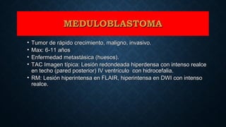 MEDULOBLASTOMAMEDULOBLASTOMA
• Tumor de rápido crecimiento, maligno, invasivo.Tumor de rápido crecimiento, maligno, invasivo.
• Max: 6-11 añosMax: 6-11 años
• Enfermedad metastásica (huesos).Enfermedad metastásica (huesos).
• TAC Imagen típica: Lesión redondeada hiperdensa con intenso realceTAC Imagen típica: Lesión redondeada hiperdensa con intenso realce
en techo (pared posterior) IV ventrículo con hidrocefalia.en techo (pared posterior) IV ventrículo con hidrocefalia.
• RM: Lesión hiperintensa en FLAIR, hiperintensa en DWI con intensoRM: Lesión hiperintensa en FLAIR, hiperintensa en DWI con intenso
realce.realce.
 