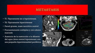 • T1: Típicamente iso a hipointensas.T1: Típicamente iso a hipointensas.
• T2: Típicamente hiperintensasT2: Típicamente hiperintensas
• Pared gruesa, masa necrótica centralPared gruesa, masa necrótica central
• Frecuentemente múltiples y con edemaFrecuentemente múltiples y con edema
marcadomarcado
• Ausencia de la restricción a la difusiónAusencia de la restricción a la difusión
del agua (área central hipointensa) condel agua (área central hipointensa) con
una pequeña hiperintensidad periféricauna pequeña hiperintensidad periférica
METASTASISMETASTASIS
 