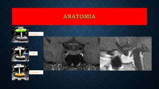 Hipófisis
Tallo
Quiasma
ANATOMIAANATOMIA
 