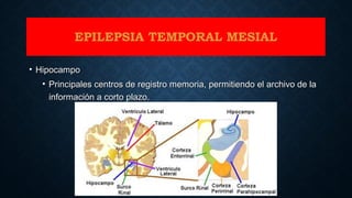 • HipocampoHipocampo
• Principales centros de registro memoria, permitiendo el archivo de laPrincipales centros de registro memoria, permitiendo el archivo de la
información a corto plazo.información a corto plazo.
EPILEPSIA TEMPORAL MESIAL
 