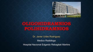 OLIGOHIDRAMNIOS
POLIHIDRAMNIOS
Dr. Javier Uribe Rodríguez
Medico Radiólogo
Hospital Nacional Edgardo Rebagliati Martins
 