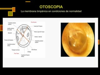 OTOSCOPIA La membrana timpánica en condiciones de normalidad 