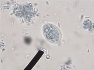 	Susceptibilidad del huésped: Inmunidad, Genética, Nutrición.