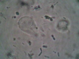 	En ocasiones la infección es de tipo familiar con niños sintomáticos 	y padres infectados asintomáticamente.PrevenciónSaneamiento ambiental.Adecuada disposición de excretas. Tratamiento de aguas servidas.Control de basuras.Control de insectos (vectores mecánicos).Prácticas de correcta higiene personal y de manipulación de alimentos.