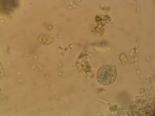 Grupo asintomático: niños bien nutridos, adultos con escasos parásitos.