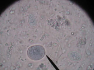 Grupo sintomático: niños menores de 6 meses con algún grado de desnutrición o respuesta inmune deficiente.