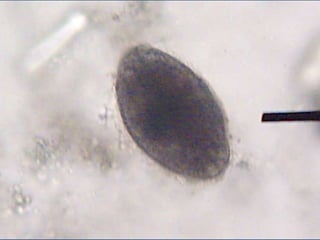 IsosporosisCuadro crónico en inmunodeprimidos.En citoplasma de enterocito en intestino delgado.Síndrome intestinal agudo febril con eosinofilia. Diarrea líquida, pastosa, lientérica. Síndrome de mala absorción.Sintomatología depende del número de parásitos y del grado de inmunosupresión.Tratamiento: Sintomático, Cotrimoxazol.10% de los pacientes con SIDA.