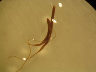 Adulto de Diphyllobothriumlatum8,8 metros de largo.