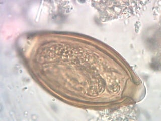 AscariasisAscarislumbricoides. 15-30 cm.Localización: I. delgado.Forma infectante: huevo con L3.Huevo se desarrolla en medio externo hasta L3 gracias a una alta humedad.Geohelmintiasis. Huevos pueden mantenerse infectantes por 2-3 años.Complicación: obstrucción intestinal por el número de parásitos. Adultos suelen vivir un año en el intestino.29% de preescolares.Diarrea recidivante, baja de peso.Tratamiento: Albendazol.