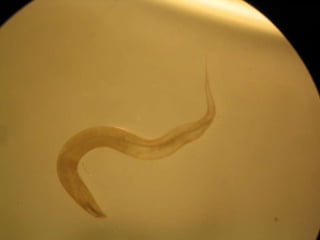 TrichuriasisTrichuristrichiura: 5cm.Localización: Intestino grueso.Se fija a la mucosa intestinal.Huevo con L1 es infectante.Disenteria: deposiciones mucosas y sanguinolentas, lesiones inflamatorias y ulcerosas del I. grueso.Anemia microcíticahipocrómica.Prolapso rectal.17% de preescolares.Tratamiento: Albendazol.