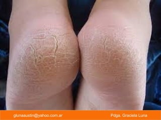 glunaaustin@yahoo.com.ar Pdga. Graciela Luna
 