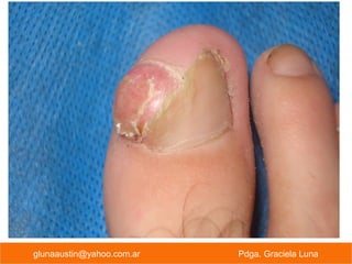 glunaaustin@yahoo.com.ar Pdga. Graciela Luna
 