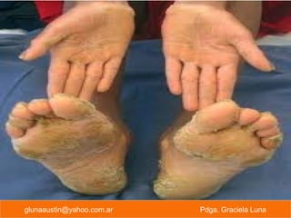 glunaaustin@yahoo.com.ar Pdga. Graciela Luna
 