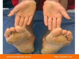 glunaaustin@yahoo,com.ar Pdga. Graciela Luna
 