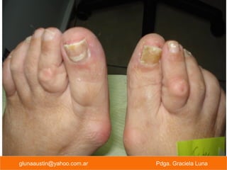 glunaaustin@yahoo.com.ar Pdga. Graciela Luna
 