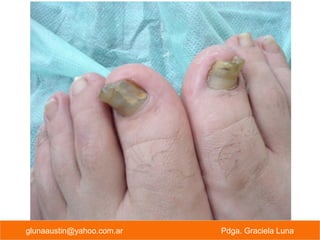 PREVENCION PRIMARIA Pdga. Graciela Lunaglunaaustin@yahoo.com.ar Pdga. Graciela Luna
 