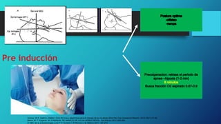 Pre inducción
Gómez. M.A. Gaitini.L.Matter.I.Smri.M.Guía y algoritmos para el manejo de la vía aérea difícil Rev Esp Anesteciol Reanim. 2016; 65(1):41-48.
María. M. F. Eugenio. M. H MANUAL DE MANEJO DE LA VIA AEREA DIFICIL. 3ra Edicion.2017.245-265.
El ABC de la anestesiología.Luna.P.O.Hurtado.C.R.Romero.J.B. México 2011: 197-213
 