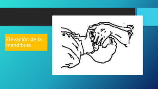 Elevación de la
mandíbula
 