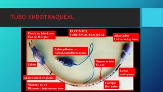 TUBO ENDOTRAQUEAL
 