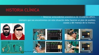 HISTORIA CLÍNICA
• Detectar antecedentes anestésicos de intubación difícil,
(siempre que nos encontremos con esta situación debe hacerse un plan de posibles
causas y del manejo de la misma).
Bes t Practice & Research Clinica l Anaesthesiology 19 (4) 2011, 559–579
 
